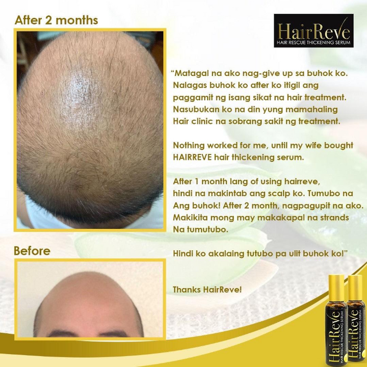 HairReve Hair Rescue Thickening SERUM 100ml (Reduce Hair Fall, Thicker Stronger Hair)