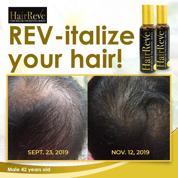 HairReve Hair Rescue Thickening SERUM 100ml (Reduce Hair Fall, Thicker Stronger Hair)