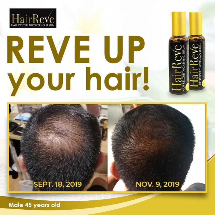 HairReve Hair Rescue Thickening SERUM 100ml (Reduce Hair Fall, Thicker Stronger Hair)